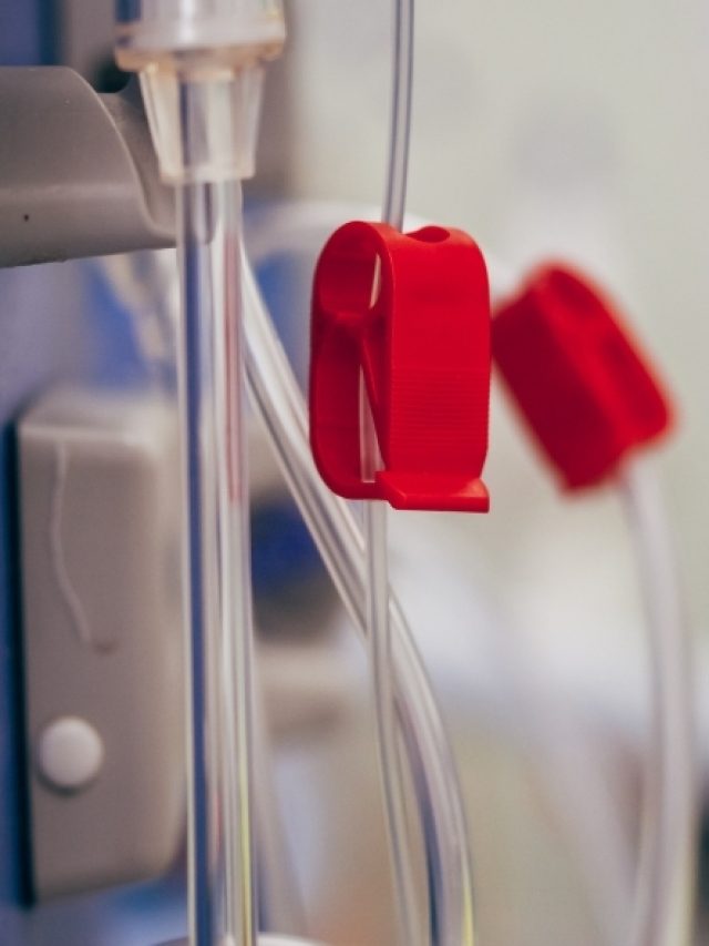 What are the Benefits of Using Bloodline Sets in Dialysis Treatments